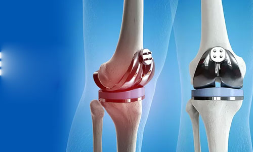 knee
